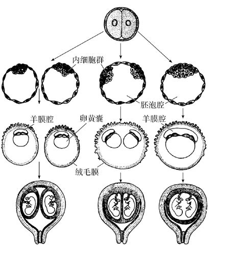 胎記 種類